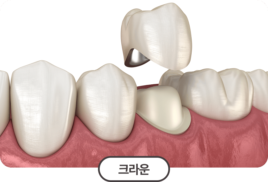 크라운