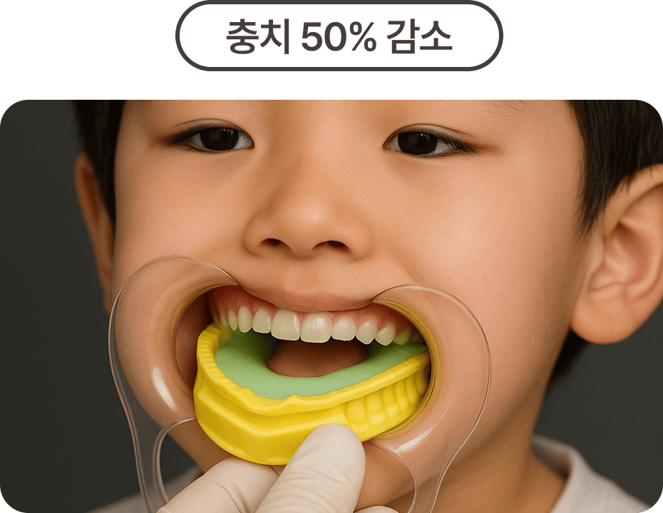 불소도포